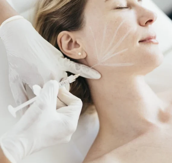 Provider injecting dermal filler along marked guide lines on a client's jaw