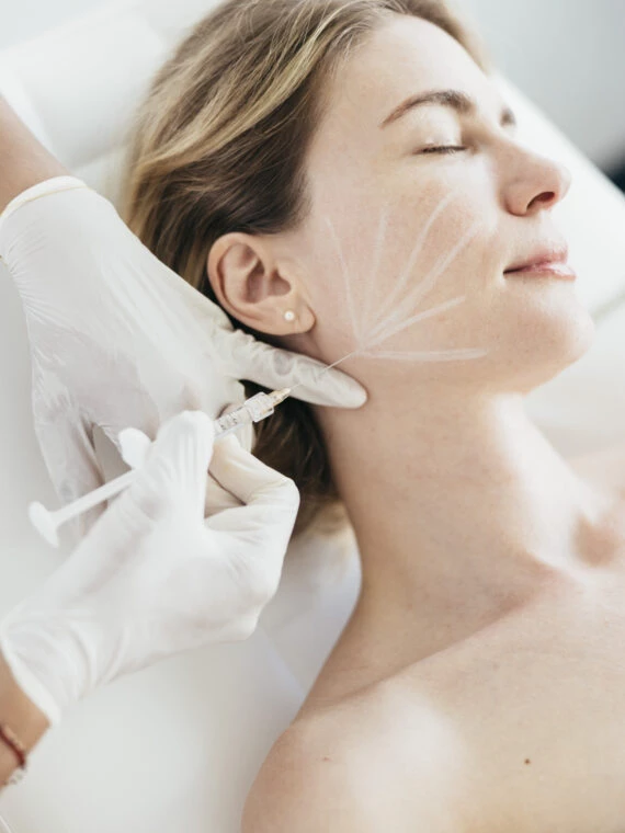 Provider injecting dermal filler along marked guide lines on a client's jaw