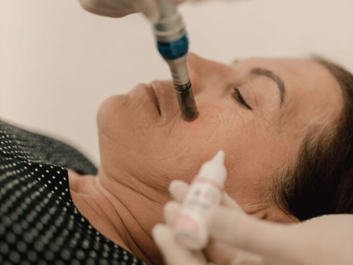 Esthetician performing microneedling on a client's cheek with a serum applied alongside