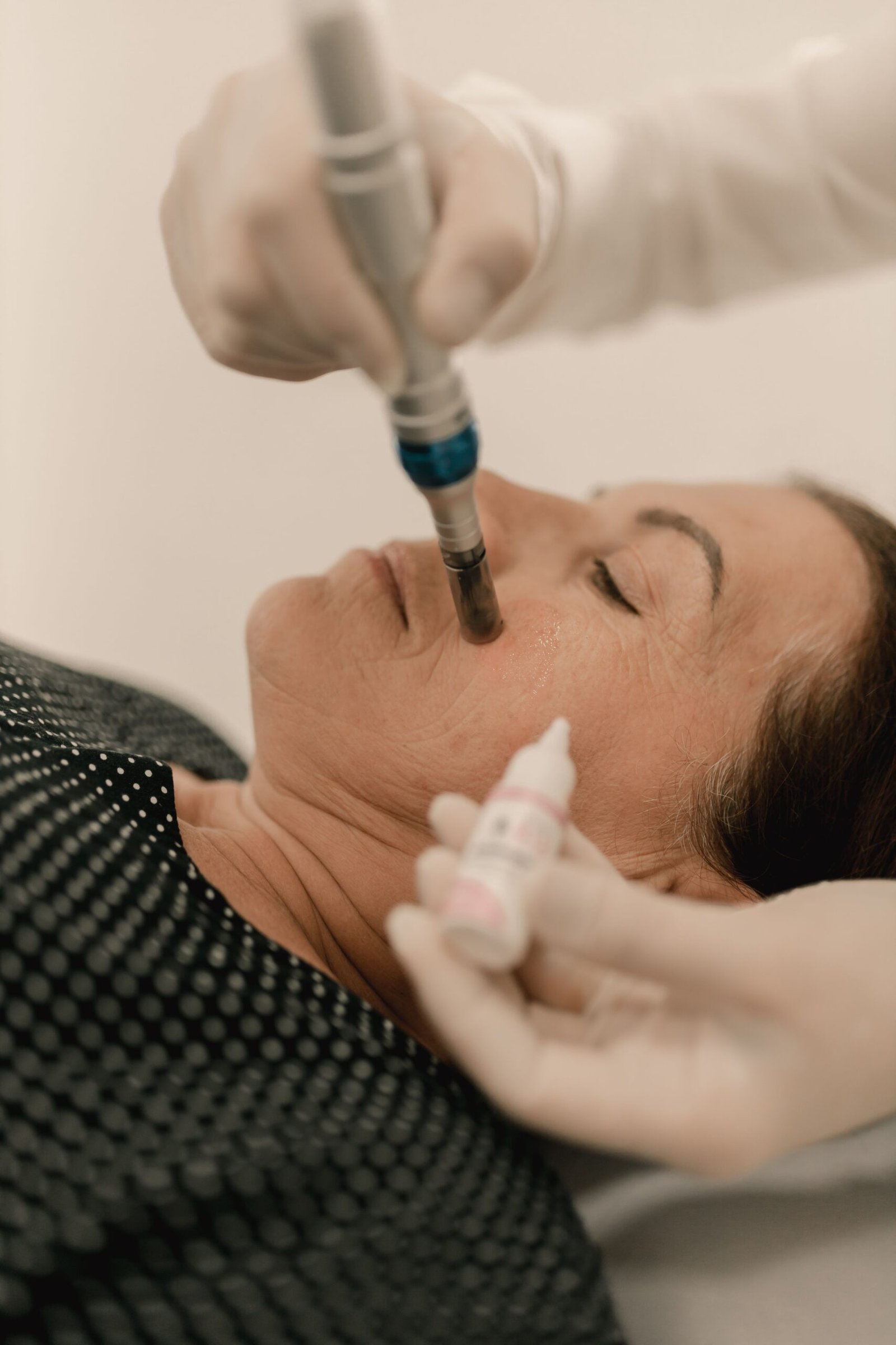 Esthetician performing microneedling on a client's cheek with a serum applied alongside